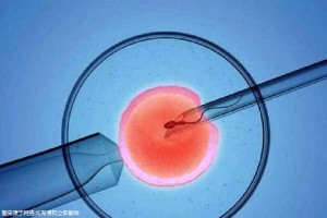 代怀选性别包生男孩试管婴儿中心
